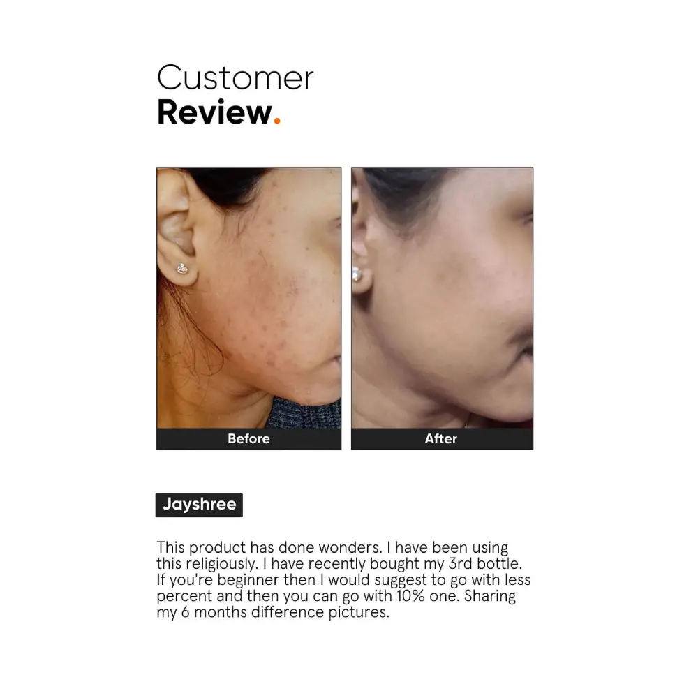 Minimalist Niacinamide 10% + zinc face serum - General product